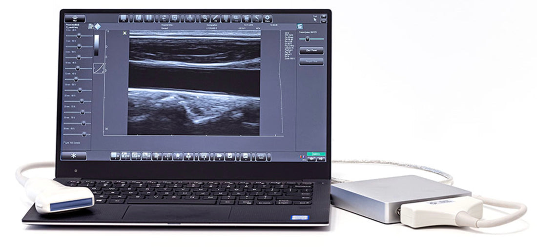 April Angebot Nr. 1 : µSono SW - Windows® B-Bild Sonografie